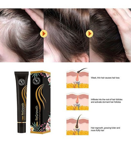 4 Peças De Sérum De Cabelo Orgânico Regrowth Roller Crescime