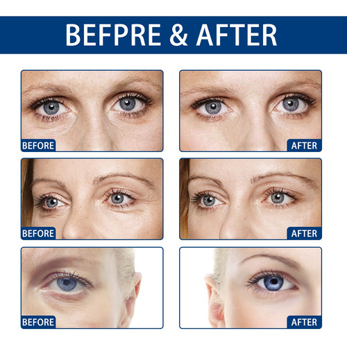 I La Crema For Ojos Con Colágeno Mejora Las Bolsas De Los