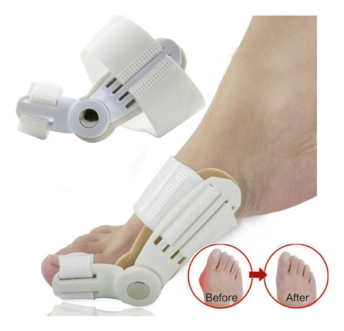 Plantilla Rígida Férula Corrector Juanetes Hallux Valgus