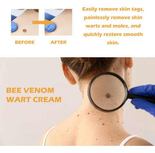 Bc Crema Premium De Miel For Verrugas 20 G*2