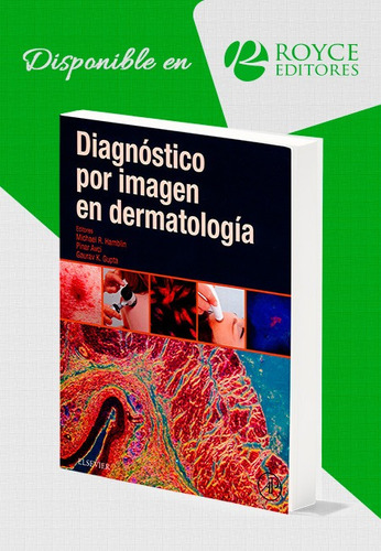 Diagnóstico Por Imagen En Dermatología