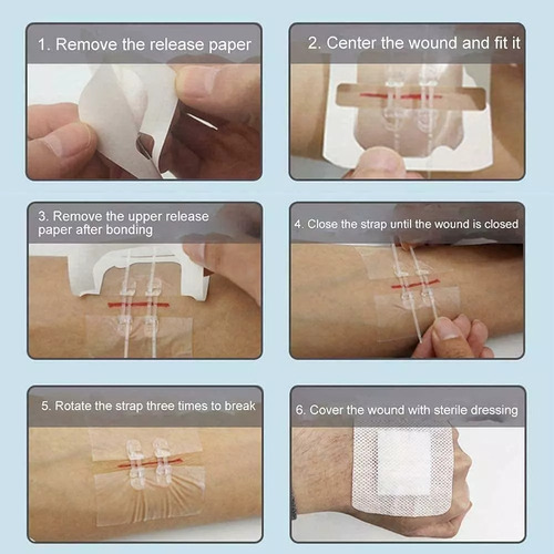 Tiras De Cierre De Heridas De Emergencia, Vendaje De Puntada