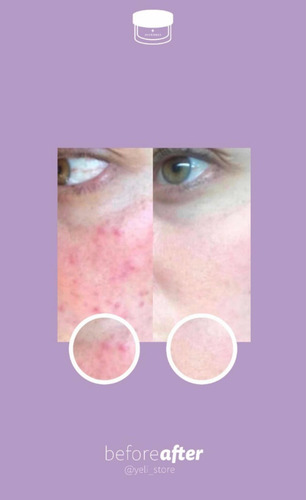 Imagen 8 de 9 de Crema Juveness Plus, Crema Para Mujer