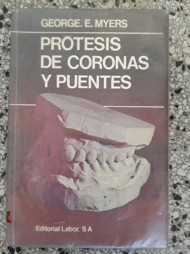 Prótesis De Coronas Y Puentes George Myers 1971 Odontología