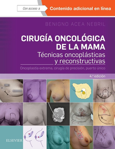 Libro Cirugã­a Oncolã³gica De La Mama (4âª Ed.)