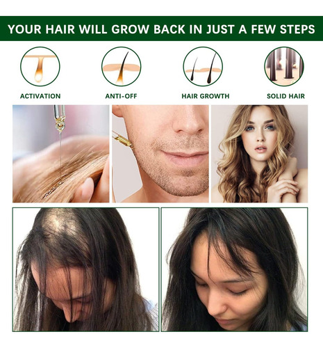 Aceite De Romero Para El Cabello,30ml Rosemary Oil For Hair