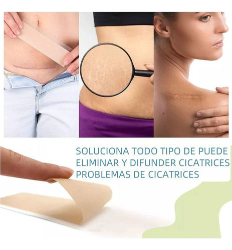 4cm*1.5 Metros Parche Silicón Reutilizable Cicatrices Rollo