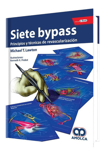 Siete Bypass Principios Y Técnicas De Revascularización