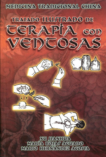 Tratado Ilustrado De Terapia Con Ventosas - Jian Hua, Rojas 