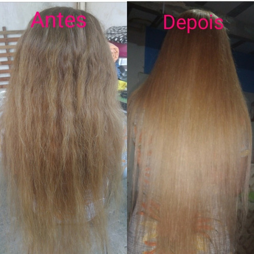 Imagem 2 de 5 de Selagem Sem Formol