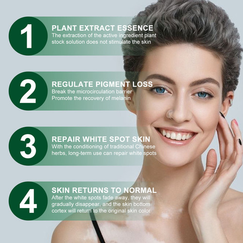 - 4×crema Para Vitíligo White, Aceite Vitíligo Localizado