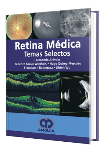 Retina Médica. Temas Selectos.