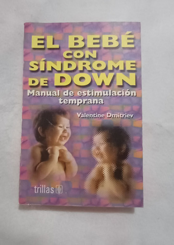 Bebe Con Síndrome De Down Manual De Estimulación Temprana, D