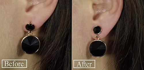 Imagen 6 de 6 de Aros Tornillos Tapón Goma Silicona 20 Unidades ... Milenoil