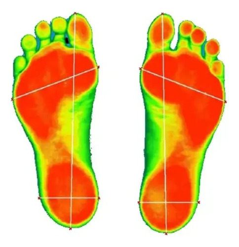 Estudio Pisada Digital Plantares Ortopédicos A Medida