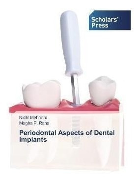Periodontal Aspects Of Dental Implants - Nidhi Mehrotra