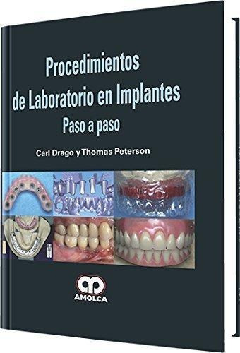 Procedimientos De Laboratorio En Implantes Paso A Paso