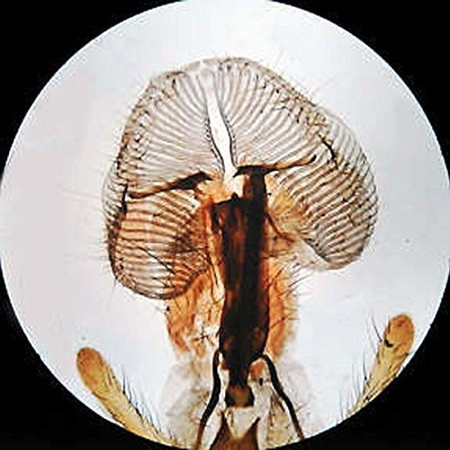 Imagen 8 de 9 de Amscope Se306r-p-led Microscopio Estéreo Binocular Con
