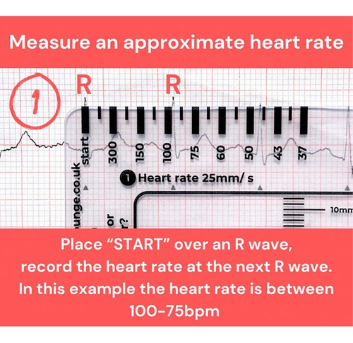 Regla Ecg De 7 Pasos De 2 Piezas, Regla De Ecg De 7 Pasos Pa