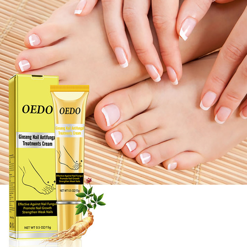 Crema Para Hongos En Las Uñas, Cuidado De Los Pies, Antimicó