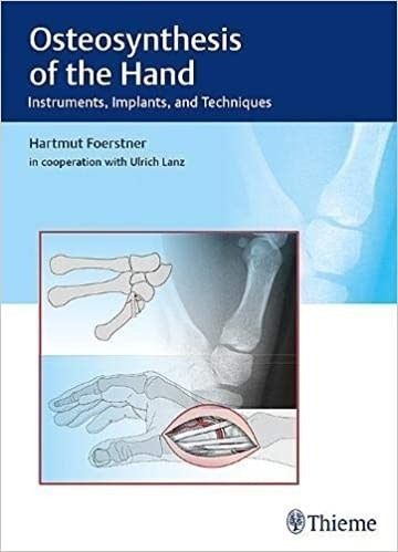 Osteosynthesis Of The Hand Instruments, Implants, And Techn