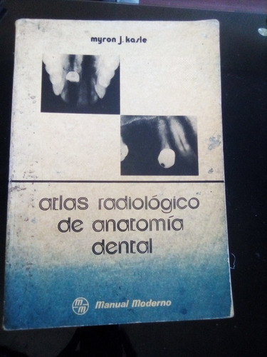 Atlas Radiologico De Anatomia Dental Myron J Kasle