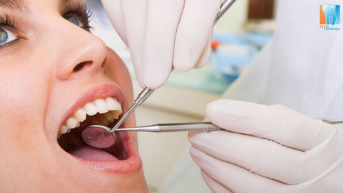 Clínica Odontológica. Limpieza Dental Y Eliminación De Sarro