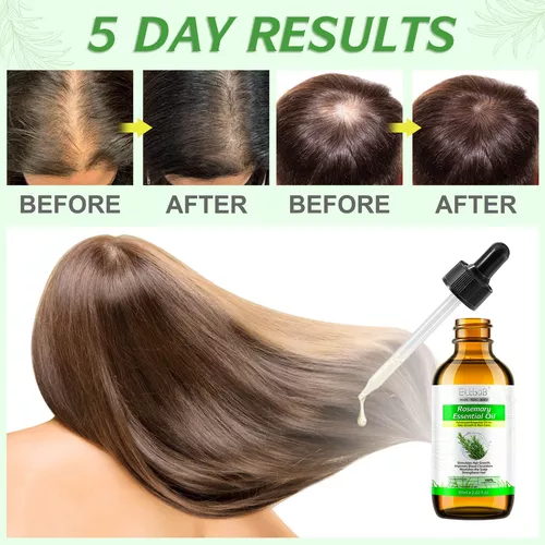 Aceite esencial de romero (2 onzas líquidas), aceite de romero para el  crecimiento del cabello y el cuidado de la piel, tratamiento del cuero