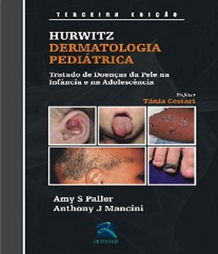 Dermatologia Pediatrica - Hurwitz - 03 Ed, De Paller, Amy S. / Mancini, Anthony J.. Editora Revinter, Capa Mole, Edição 3 Em Português