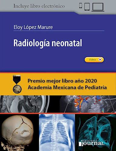 Radiología Neonatal