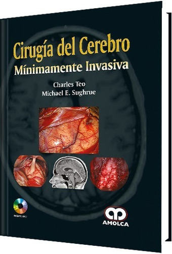 Ciruga Del Cerebro Minimamente Invasiva,jk