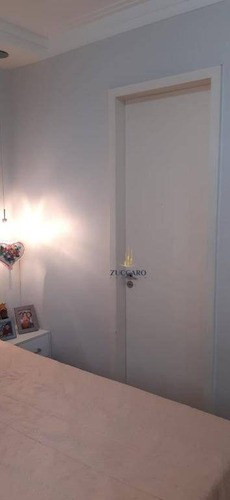 Lindo Apartamento Vista Livre Com 2 Dormitórios À Venda, 64 M² Por R$ 409.000 - Gopoúva - Guarulhos/sp - Ap16854