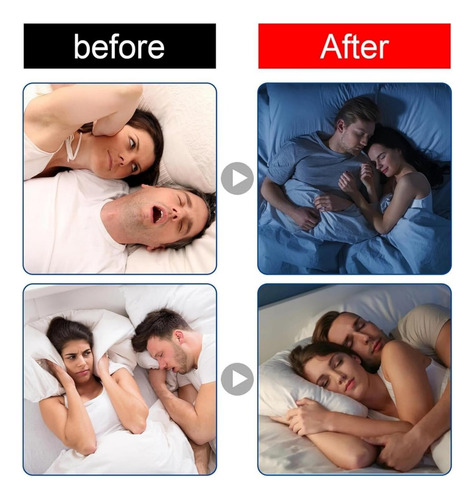 Cinta De Lavanda Para Dormir, Cinta Bucal Para Dormir Y Ronc