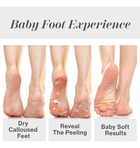 Exfoliante Para Pies Eliminador De Callos Para Pies Ásperos
