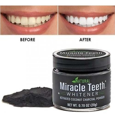 Blanqueador De Dientes Miracle Teeth Whitener Carbón Polvo