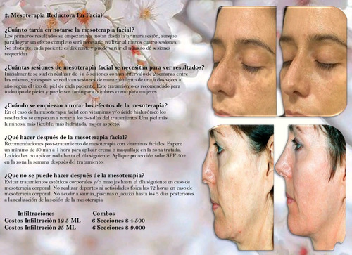 Tienes Flacidez En La Cara Mesoterapia Reductora En Facial