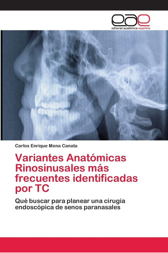 Libro: Variantes Anatómicas Rinosinusales Más Frecuentes Ide