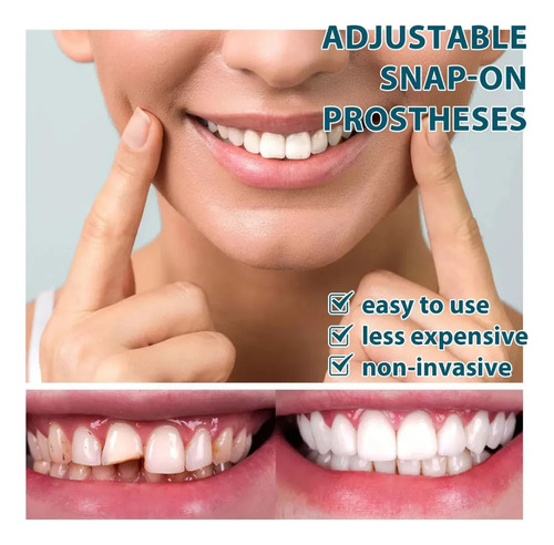 Soportes De Montaje Ajustables Para Dentaduras Temporales Re