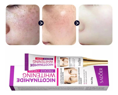 Crema blanqueadora eliminadora de melanina, melasma y pecas Tiempo de aplicación Día/noche Tipo de piel Todo tipo de piel