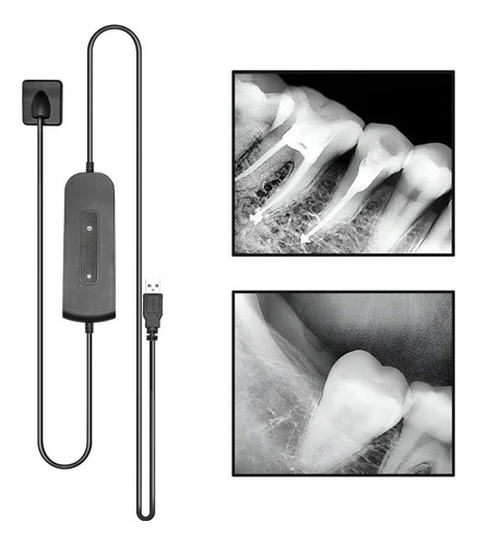 Sensor Digital Rayos X Dental Radiovisografo Intraoral Xray