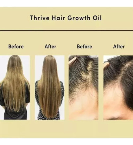 4pcs Veganic Hair Essential Oil For Hair Care,