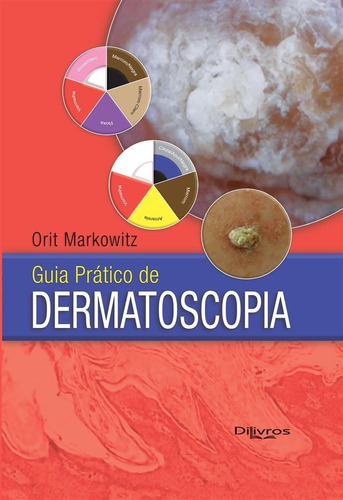 Livro: Guia Pratico De Dermatoscopia