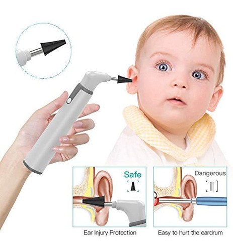 Otoscopio Inalámbrico Con Doble Vista, 0.154 in, 720phd, Wif