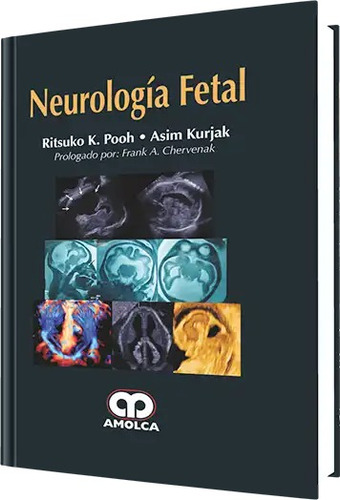 Neurología Fetal