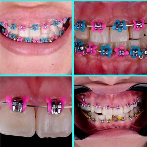 Ligas Para Brackets Figuras Flores Colores