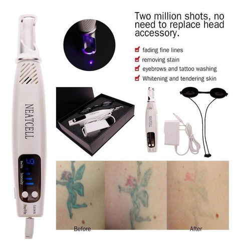 Imagen 3 de 6 de Laser Neatcell Picosegundo L Para Manchas,tatuajes, Y Mas!