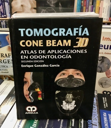 Libro - Tomografía Cone Beam 3d Atlas De Aplicaciones En Odo