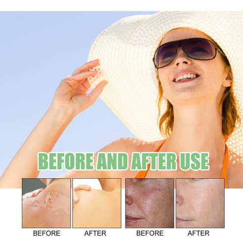 Protector Solar Hidratante En Barra Z Spf50 Dont Let The Sun