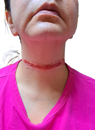 Aplicación Heridas De Silicón Hipoalergénicas, Chicas