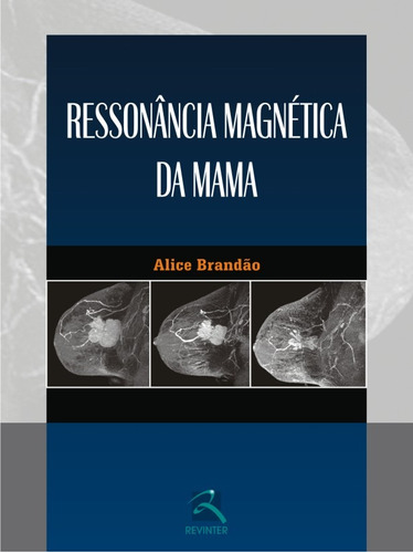 Ressonância Magnética da Mama, de Brandão, Alice. Editora Thieme Revinter Publicações Ltda, capa dura em português, 2015